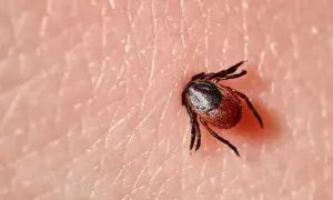 Czy kleszcz boli? Odkryj prawdę o bólu po ugryzieniu kleszcza