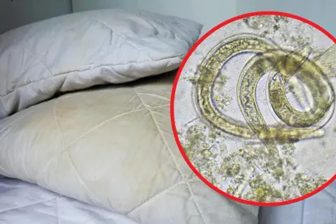 Kiedy zmienić pościel po odrobaczaniu, aby uniknąć reinfekcji?