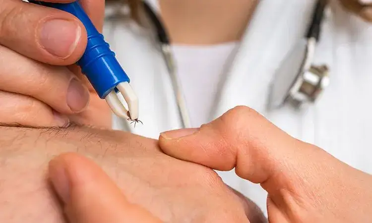 Zdjęcie Jak pozbyć się kleszczy: skuteczne metody i bezpieczeństwo usuwania